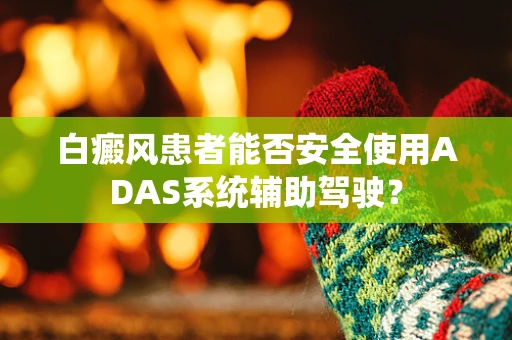 白癜风患者能否安全使用ADAS系统辅助驾驶？